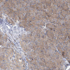 Anti-TJAP1 Antibody