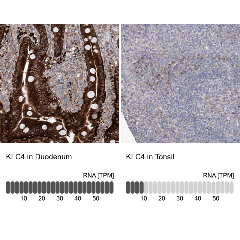 Anti-KLC4 Antibody