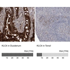 Anti-KLC4 Antibody