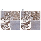 Immunohistochemical staining of human gastrointestinal, kidney, placenta and tonsil using Anti-KLC4 antibody HPA030168 (A) shows similar protein distribution across tissues to independent antibody HPA030169 (B).