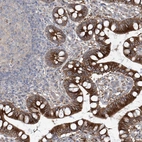 Immunohistochemical staining of human Small intestine shows strong cytoplasmic positivity in glandular cells.