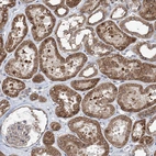 Immunohistochemical staining of human Kidney shows moderate cytoplasmic positivity in cells in tubules.