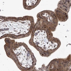 Immunohistochemical staining of human Placenta shows strong cytoplasmic positivity in trophoblastic cells.