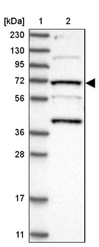 Lane 1: Marker [kDa] 230, 130, 95, 72, 56, 36, 28, 17, 11_br/_Lane 2: Human cell line RT-4
