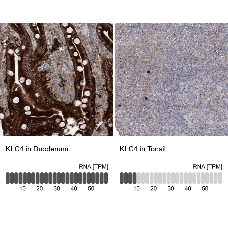 Anti-KLC4 Antibody