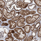 Immunohistochemical staining of human Kidney shows moderate cytoplasmic positivity in cells in tubules.
