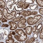 Immunohistochemical staining of human Kidney shows moderate cytoplasmic positivity in cells in tubules.