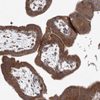 Immunohistochemical staining of human Placenta shows strong cytoplasmic positivity in trophoblastic cells.
