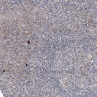 Immunohistochemical staining of human Tonsil shows very weak cytoplasmic positivity in non-germinal center cells.