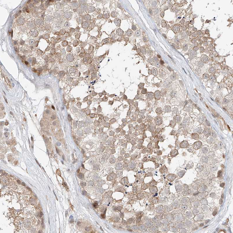 Anti-CEP162 Antibody