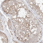Anti-CEP162 Antibody