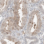 Immunohistochemical staining of human endometrium shows strong positivity in cilia in glandular cells, as well as modertae cytoplasmic and nuclear positivity in a subset of cells.