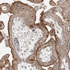 Immunohistochemical staining of human placenta shows strong membranous positivity in trophoblastic cells.