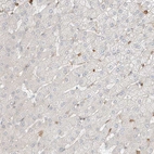 Immunohistochemical staining of human liver shows no positivity in hepatocytes as expected.