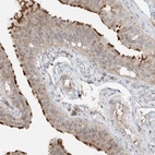 Immunohistochemical staining of human fallopian tube shows strong positivity in cilia in glandular cells.