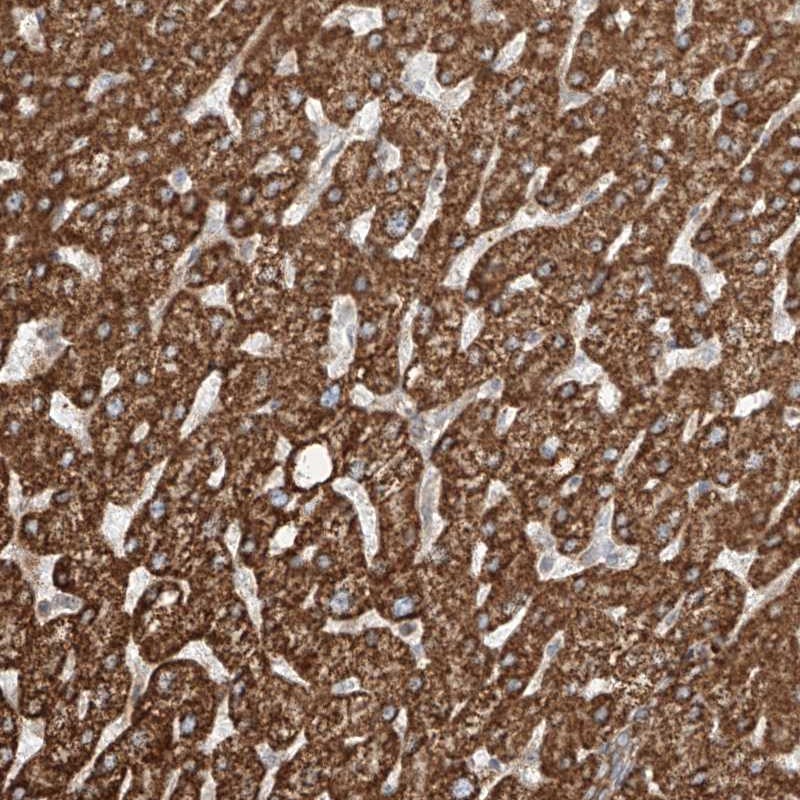 Anti-CEP162 Antibody