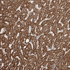 Anti-CEP162 Antibody