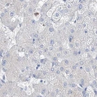 Immunohistochemical staining of human liver using Anti-FRS3 antibody HPA030174.