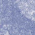 Immunohistochemical staining of human lymph node using Anti-FRS3 antibody HPA030174.