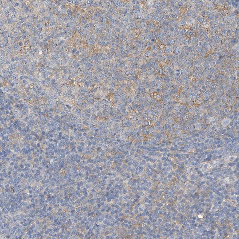 Anti-MICAL1 Antibody
