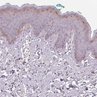 Immunohistochemical staining of human skin shows moderate positivity in stratum granulosum.