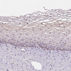 Immunohistochemical staining of human cervix, uterine shows moderate positivity in squamous epithelial cells.