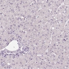 Immunohistochemical staining of human liver shows no positivity in hepatocytes as expected.