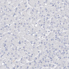 Immunohistochemical staining of human liver shows no positivity in hepatocytes as expected.