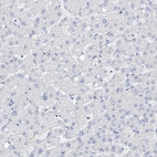 Immunohistochemical staining of human liver shows no positivity in hepatocytes as expected.