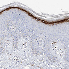 Immunohistochemical staining of human skin shows strong granular cytoplasmic positivity in keratinocytes.