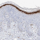 Immunohistochemical staining of human skin shows strong granular cytoplasmic positivity in keratinocytes.