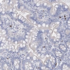 Immunohistochemical staining of human gastrointestinal shows no positivity in glandular cells as expected.