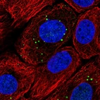 Immunofluorescent staining of human cell line HaCaT shows localization to vesicles.