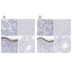 Immunohistochemical staining of human gastrointestinal, liver, skin and testis using Anti-FLG antibody HPA030189 (A) shows similar protein distribution across tissues to independent antibody HPA030188 (B).