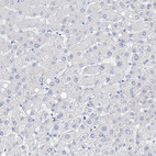 Immunohistochemical staining of human liver shows no positivity in hepatocytes as expected.