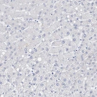 Immunohistochemical staining of human liver shows no positivity in hepatocytes as expected.
