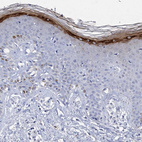 Immunohistochemical staining of human skin shows strong granular cytoplasmic positivity in keratinocytes.