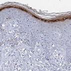 Immunohistochemical staining of human skin shows strong granular cytoplasmic positivity in keratinocytes.