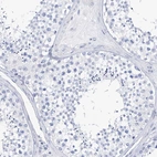 Immunohistochemical staining of human testis shows no positivity in cells in seminiferous ducts as expected.