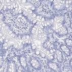 Immunohistochemical staining of human gastrointestinal shows no positivity in glandular cells as expected.