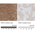 Anti-PDXK Antibody