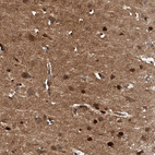 Immunohistochemical staining of human cerebral cortex shows moderate to strong cytoplasmic positivity in neurons.