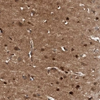 Immunohistochemical staining of human cerebral cortex shows moderate to strong cytoplasmic positivity in neurons.