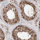 Immunohistochemical staining of human testis shows moderate to strong cytoplasmic positivity in cells in seminiferous ducts.