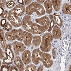 Immunohistochemical staining of human kidney shows moderate cytoplasmic positivity in cells in tubules.