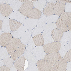 Immunohistochemical staining of human skeletal muscle shows very weak positivity in a subset of myocytes.