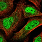 Immunofluorescent staining of human cell line U-2 OS shows localization to nucleoplasm.