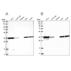 Anti-PDXK Antibody