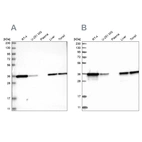Western blot analysis using Anti-PDXK antibody HPA030197 (A) shows similar pattern to independent antibody HPA030196 (B).