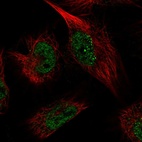 Immunofluorescent staining of human cell line U-251 MG shows localization to nucleoplasm.